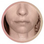 Facephysics intensive Course: Upper Lip Lift